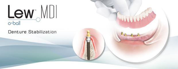 Dental Implants Made with the Highest Quality Standards
